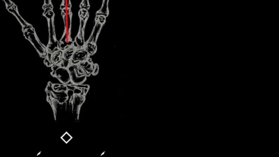 MISSIO - Middle Fingers