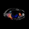 Torsten Kugler - Love Your Soul