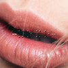 Vacra - XOXO
