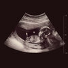 Amanda Ong、the fool - We're Having A Baby