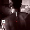 Yaha Zveroboy - Bipolar Disorder