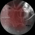 A-Kintero、Andres Acevedo - Dhyana (Original Mix)