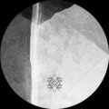 Setaoc Mass - True lies