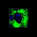 Trvxzen、Kvaxa - Ploaia