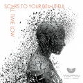 VoicePlay、J.None - Scars to Your Beautiful / All Time Low (feat. J.None)
