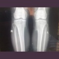 陈柏琪 - 一个人的孤单