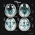 Nate Good - X-Ray (Explicit)