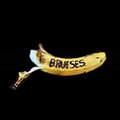 Bruises - Psychles