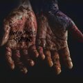 Motions - Cancer Verses