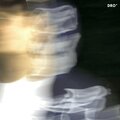 ChrisLOL - DRO* (Explicit)