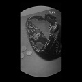 Crypto、MetroLink - Mixed (Explicit)