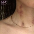 zev - Hickeys
