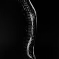 Angelo - Vipera