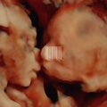 The Parasitic Relationship Between Man and S.C. (Explicit)