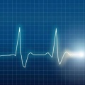 PULS (Explicit)